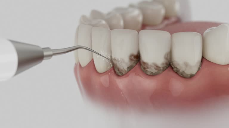 Reliable Dental Implants contractor in Quantico Base, VA by Smile Center Dentistry